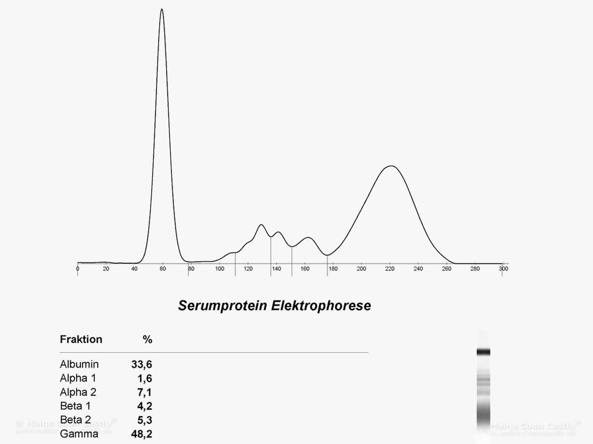 grafische Darstellung einer Serumprotein Elektrophorese grafische Darstellung einer Serumprotein Elektrophorese